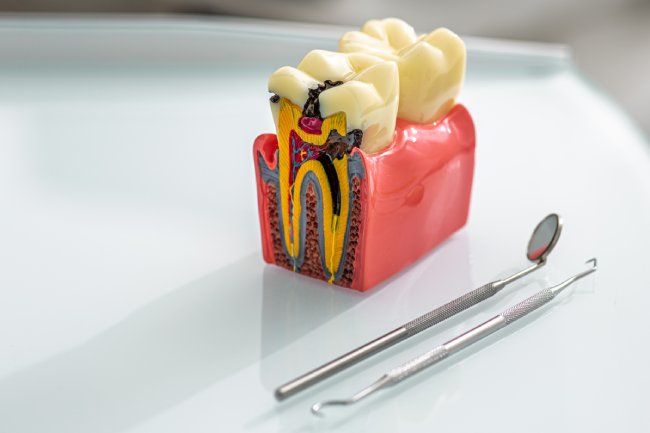 Maintenance of Periodontal Disease