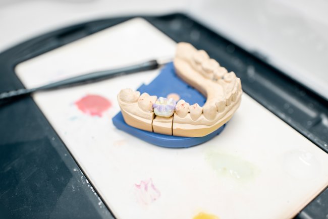 Dental Crown