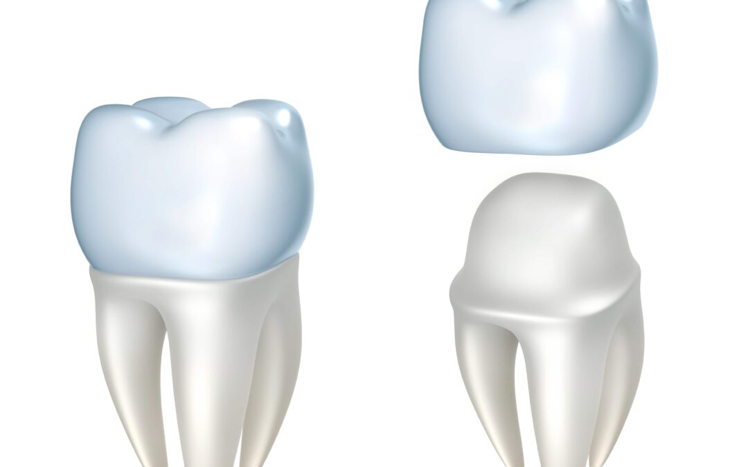 Cambridge dentist: Perfect smile with Dental Crowns