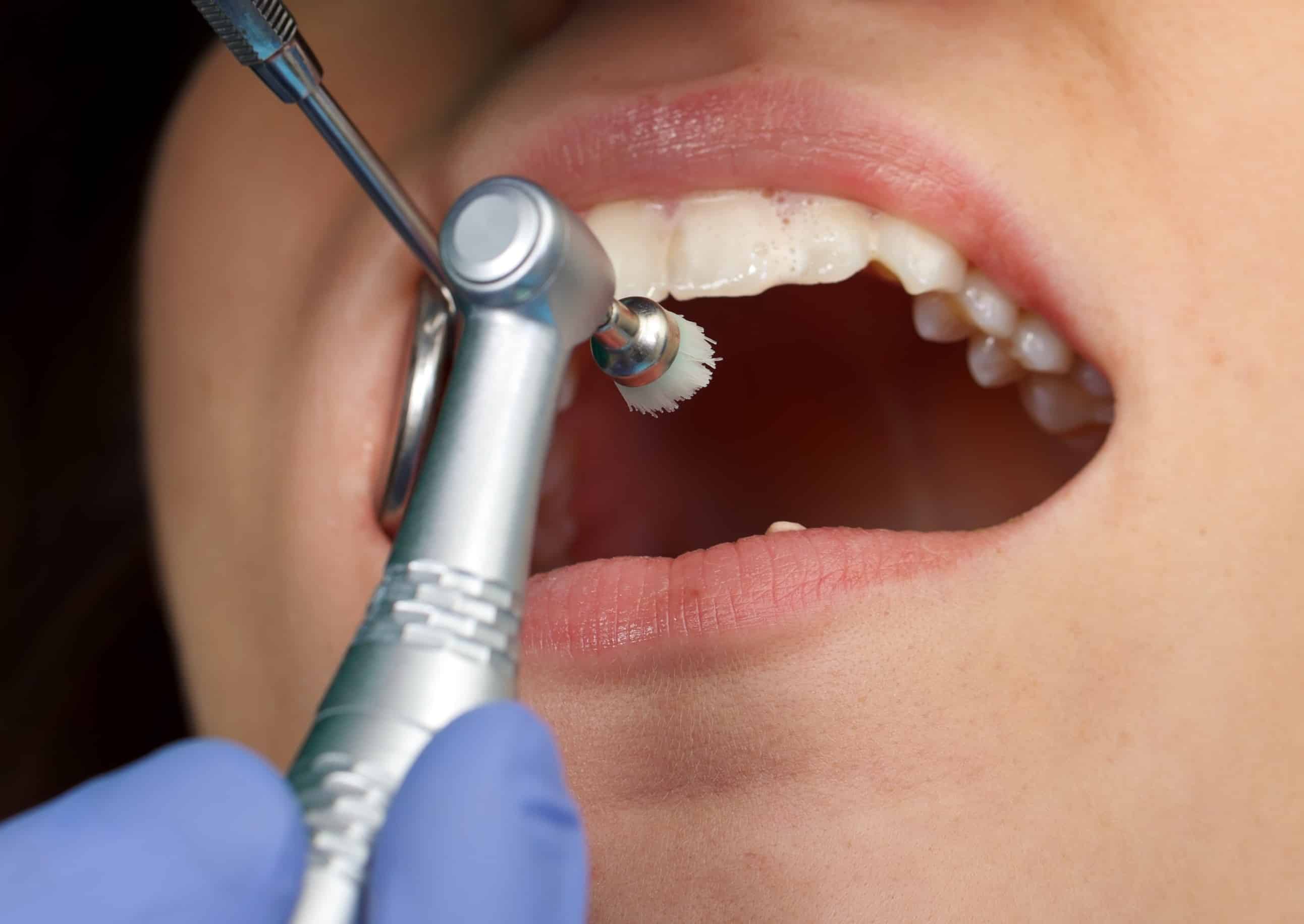 Top 5 Cosmetic Dentistry Procedures.